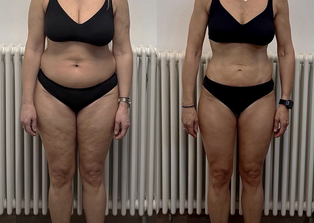 Trasformazione in 6 mesi con il metodo EGO